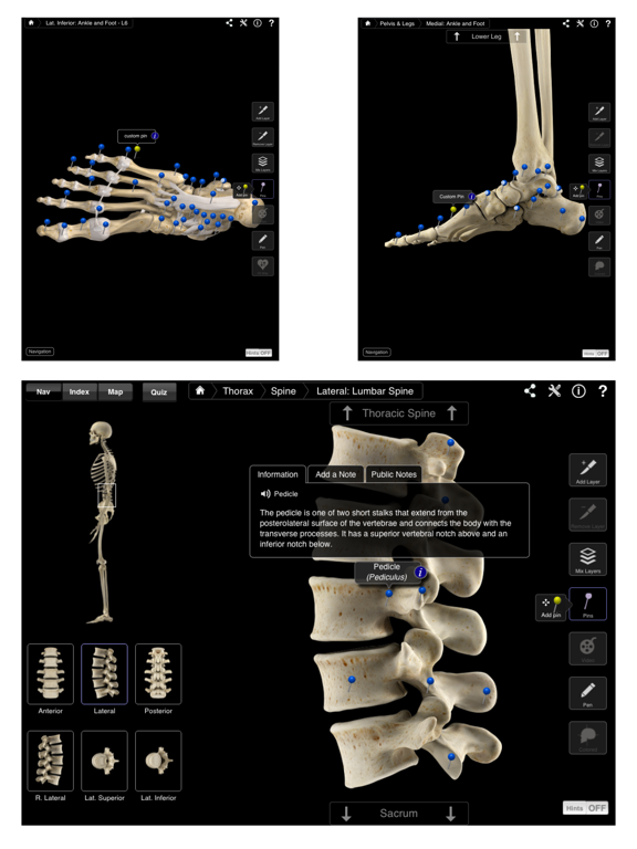 Skeleton System Pro III